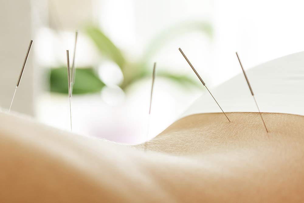 How And Why Does Acupuncture Work?